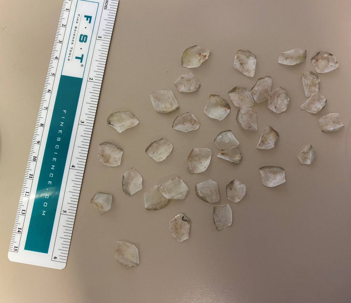 Small, translucent scales, each about a half inch square, seen on a tabletop next to a ruler. 