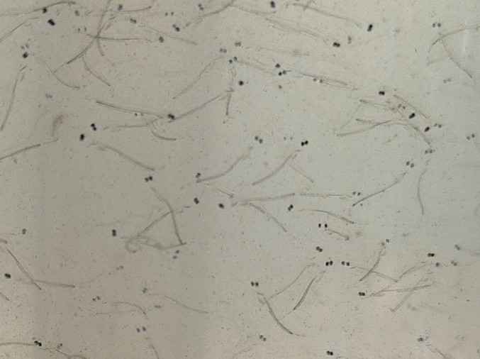 a view of dirty water wth many small dots, baby fish, swimming in it.
